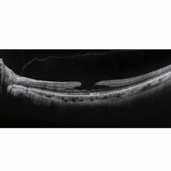 OCT Optikai Koherencia-Tomográf – VCT-550 - Image 5
