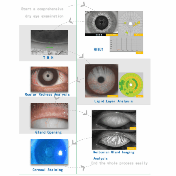Könnyfilm- és Ocularis Felszínanalizátor Dry Eye Analyzer – VDE-50A - Image 4