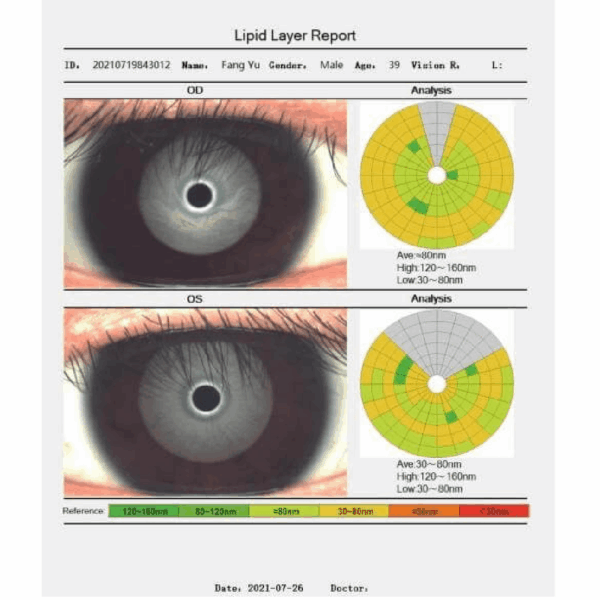 Könnyfilm- és Ocularis Felszínanalizátor Dry Eye Analyzer – VDE-50A - Image 5