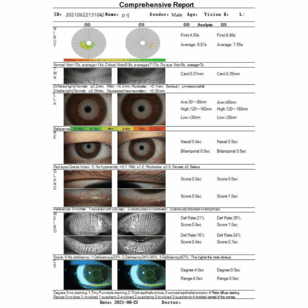 Könnyfilm- és Ocularis Felszínanalizátor Dry Eye Analyzer – VDE-50A - Image 6