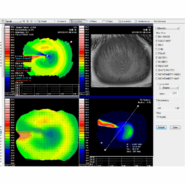 Cornea-topográf Placido Gyűrűs Technológiával – VTO-600 - Image 4