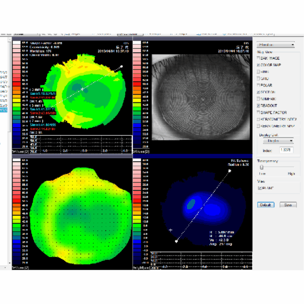 Cornea-topográf Placido Gyűrűs Technológiával – VTO-600 - Image 3